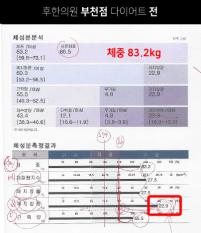 치료 전