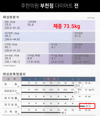 치료 전