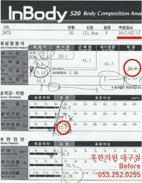 치료 전