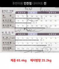 치료 전