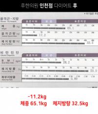 치료 후