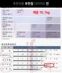 치료 전