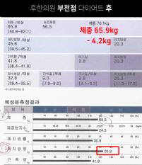 치료 후
