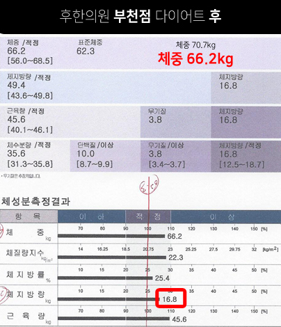 치료 후