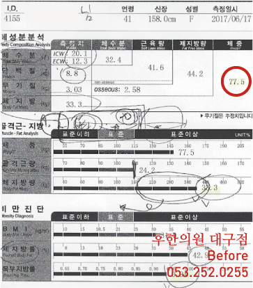치료 전