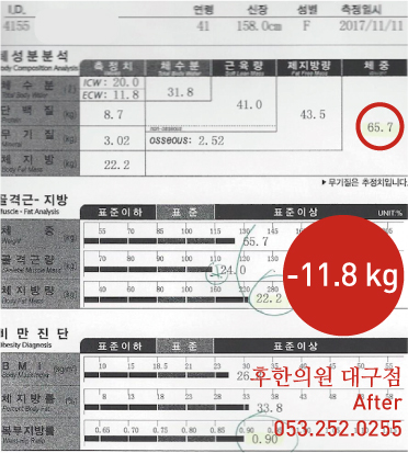 치료 후