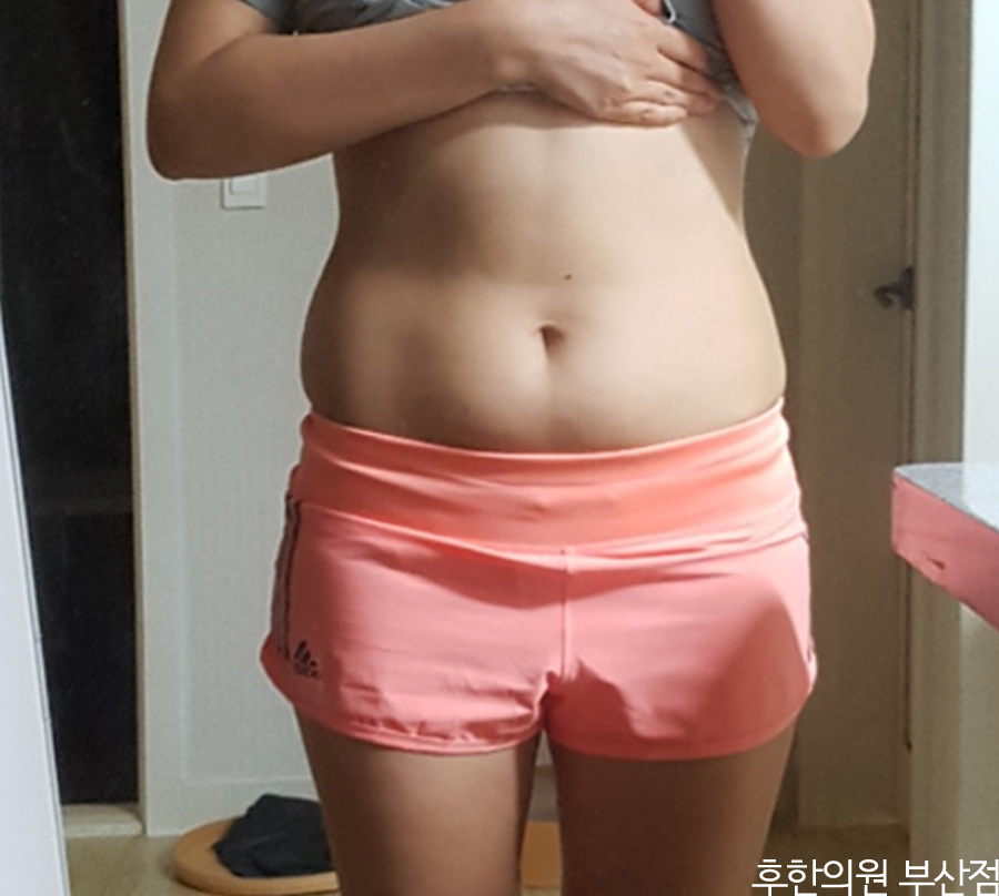 치료 전