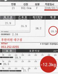 치료 후