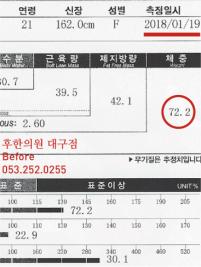 치료 전