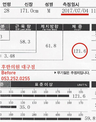 치료 전