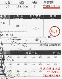 치료 전