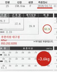 치료 후