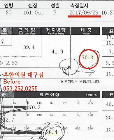 치료 전