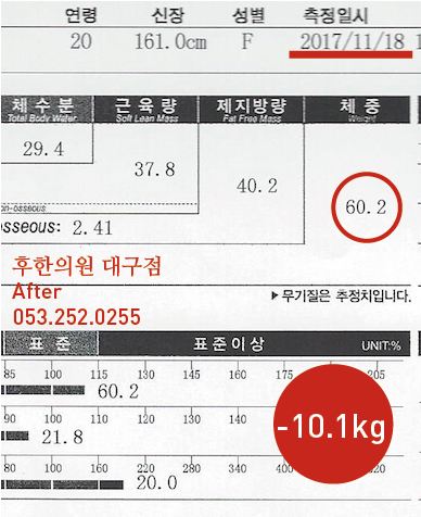 치료 후