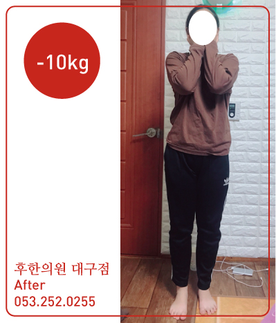 치료 후