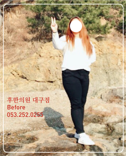 치료 전