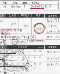 치료 전