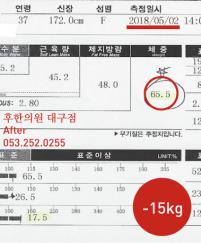 치료 후