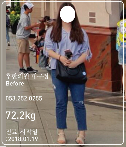 치료 전