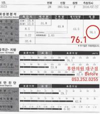 치료 전