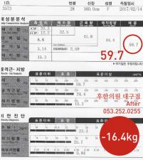 치료 후