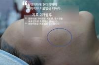 치료 후