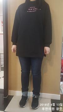 치료 후
