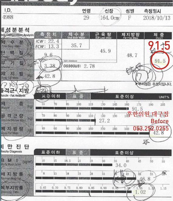치료 전