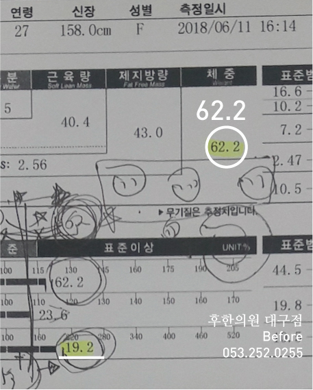 치료 전