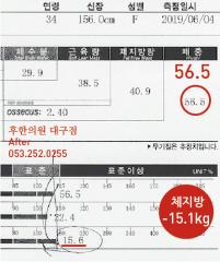 치료 후