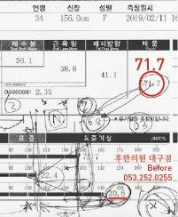 치료 전