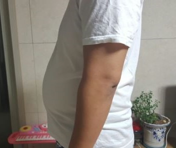 치료 전