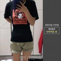 치료 후