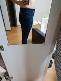 치료 후
