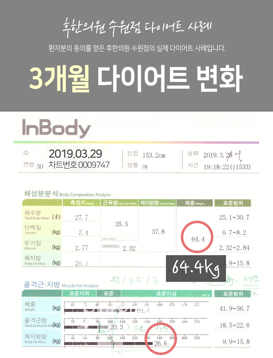 치료 전