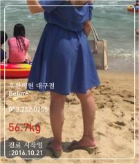 치료 전