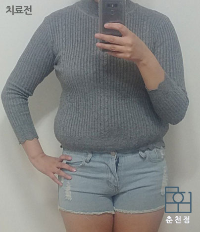 치료 전