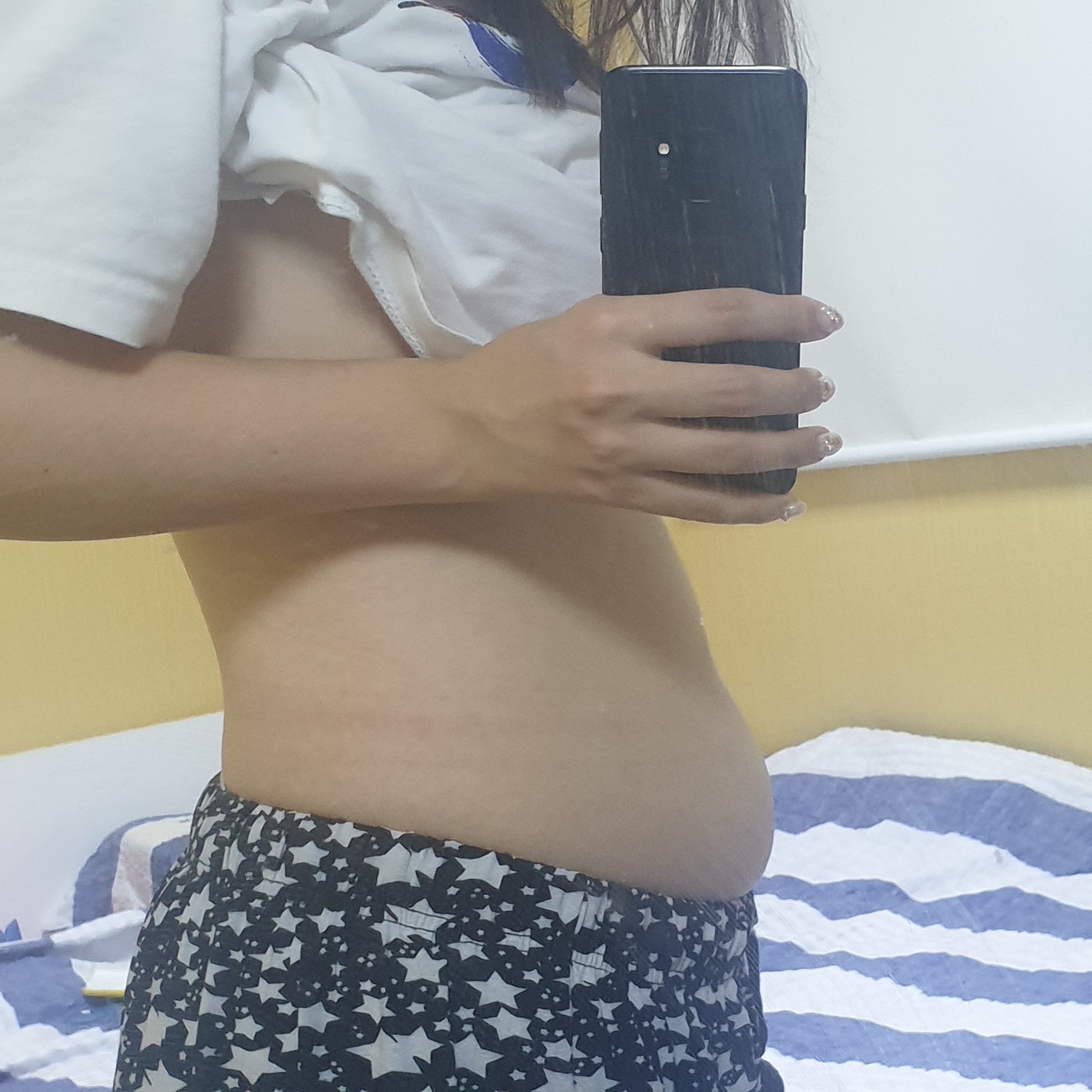 치료 후