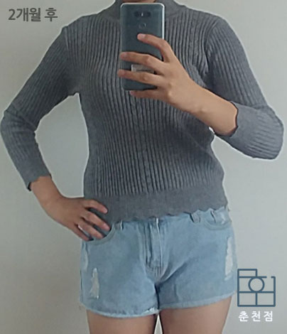 치료 후