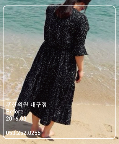 치료 전