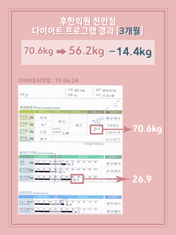 치료 전