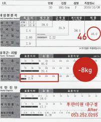 치료 후