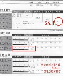 치료 전