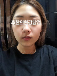 치료 후