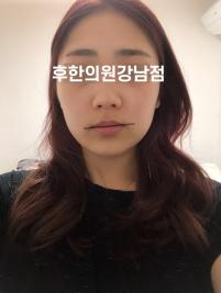치료 전