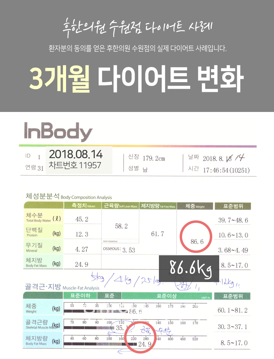 치료 전