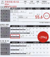치료 후