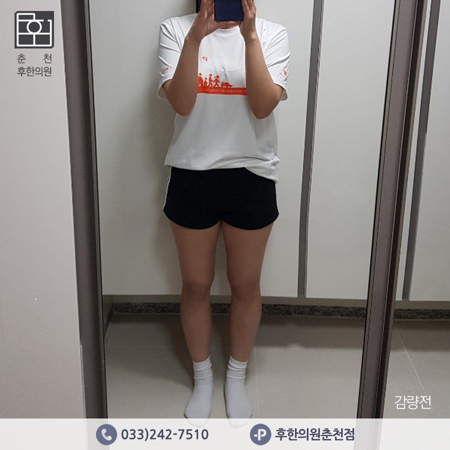 치료 전