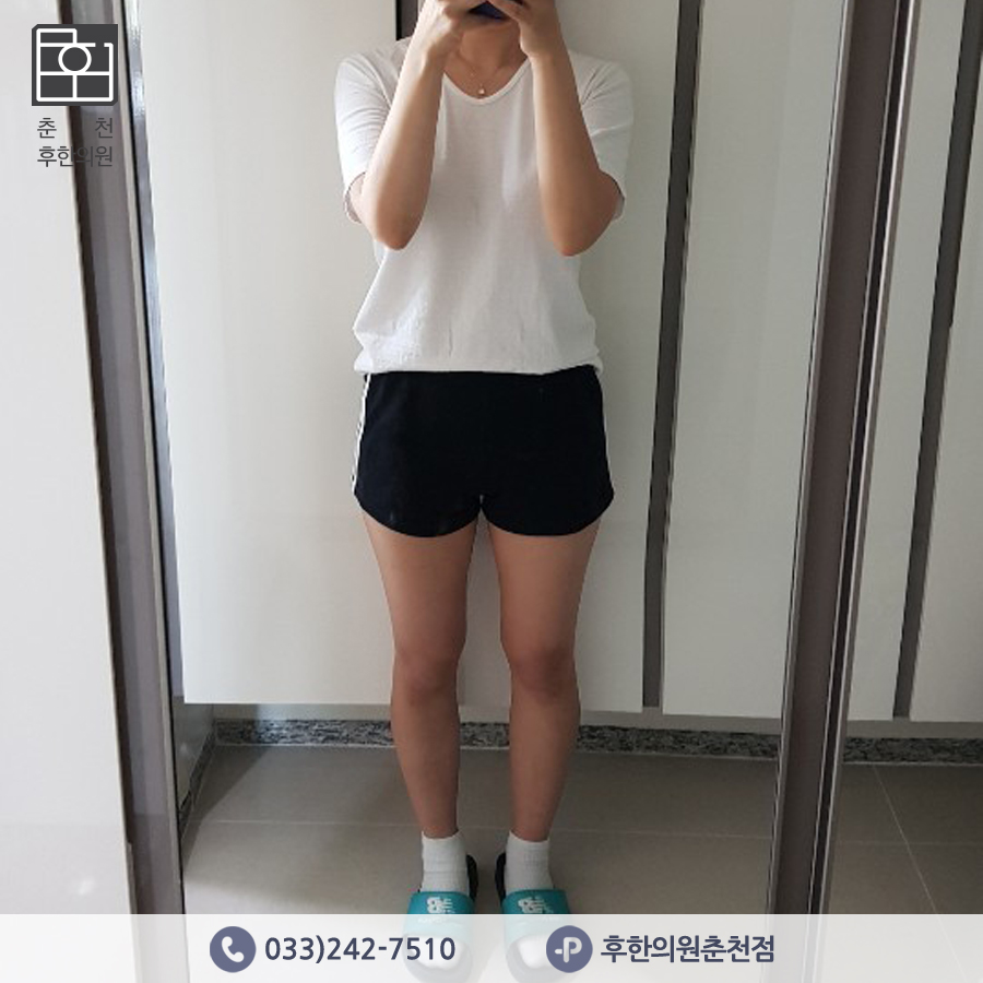 치료 후