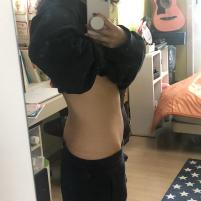 치료 후
